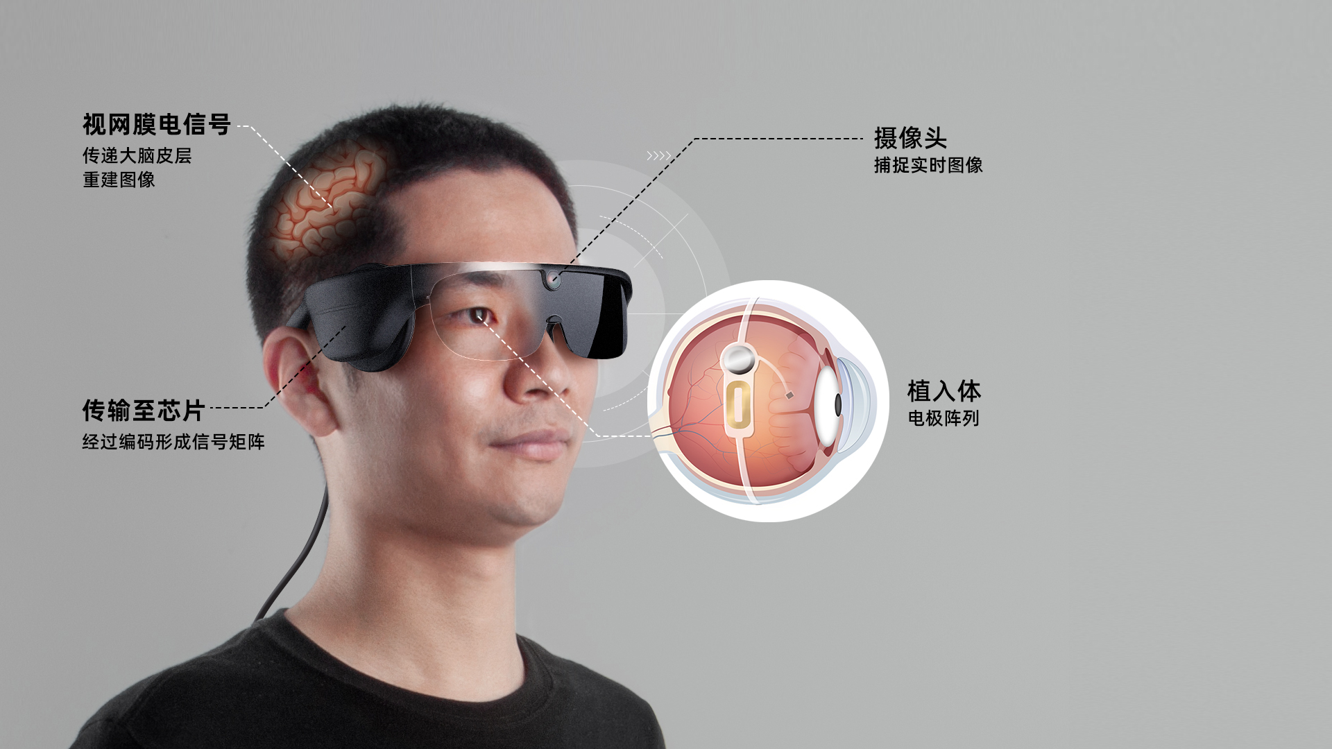 暖芯迦高分辨率人工视网膜·食蟹猴抓取任务探究取得阶段性成果